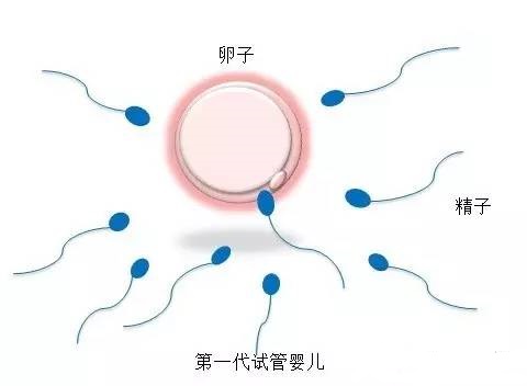 关于爱心拉拉代怀咨询怎么选